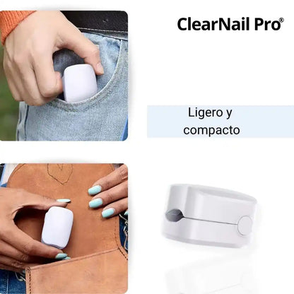 🔥¡Compra 1 y llévate 1 GRATIS! ✨ClearNail Pro® Dispositivo láser para tratamiento de hongos en las uñas