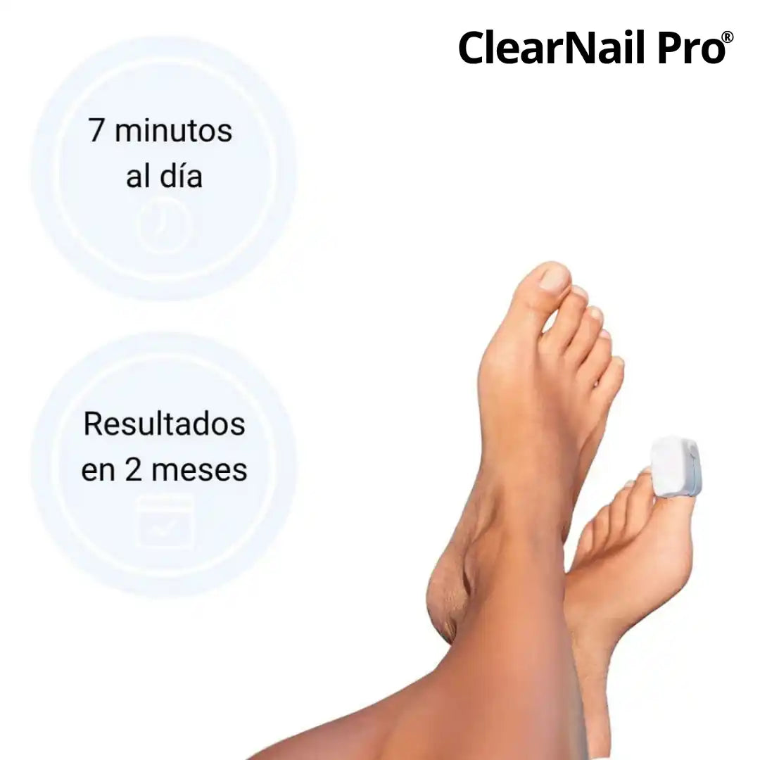 🔥¡Compra 1 y llévate 1 GRATIS! ✨ClearNail Pro® Dispositivo láser para tratamiento de hongos en las uñas